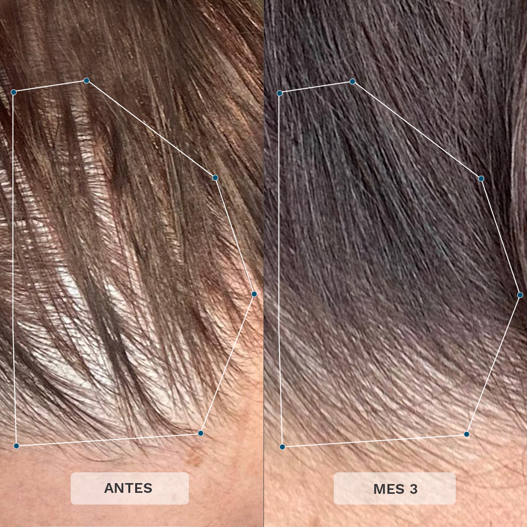 Vitaminas Capilares para Mujeres de +35