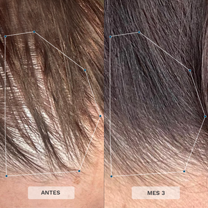 Vitaminas Capilares para Mujeres de +35