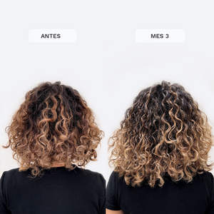 Set para el Crecimiento del Pelo con Vitaminas Masticables