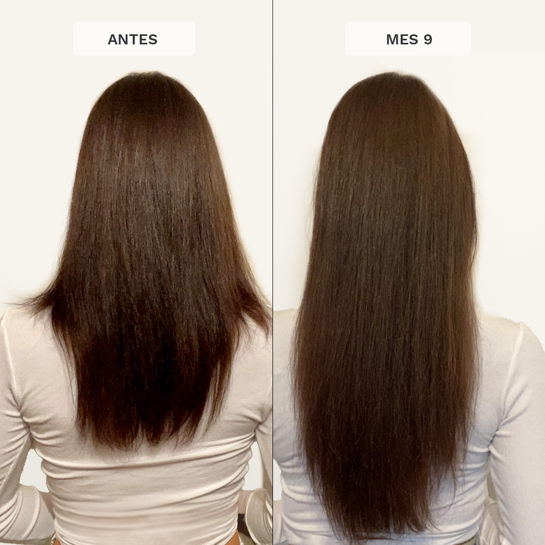 Set para el Crecimiento del Pelo con Vitaminas Originales