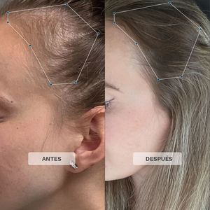 Vitaminas Capilares para Mamás